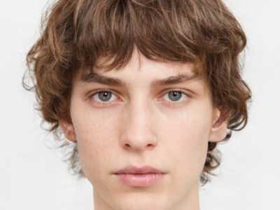 东莞眼部上睑松弛矫正医院榜单:精选几家优质机构推荐