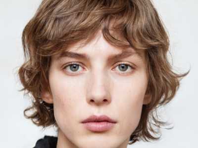 2026年眼皮重睑手术安全指南：如何避免风险与后遗症，附恢复期关键注意事项